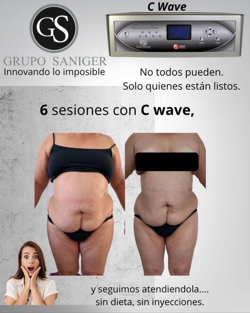 Aparatología estética CWAVE LIPOLISIS