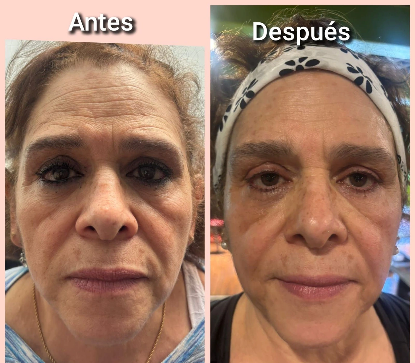 Medicina Estética y Regenerativa