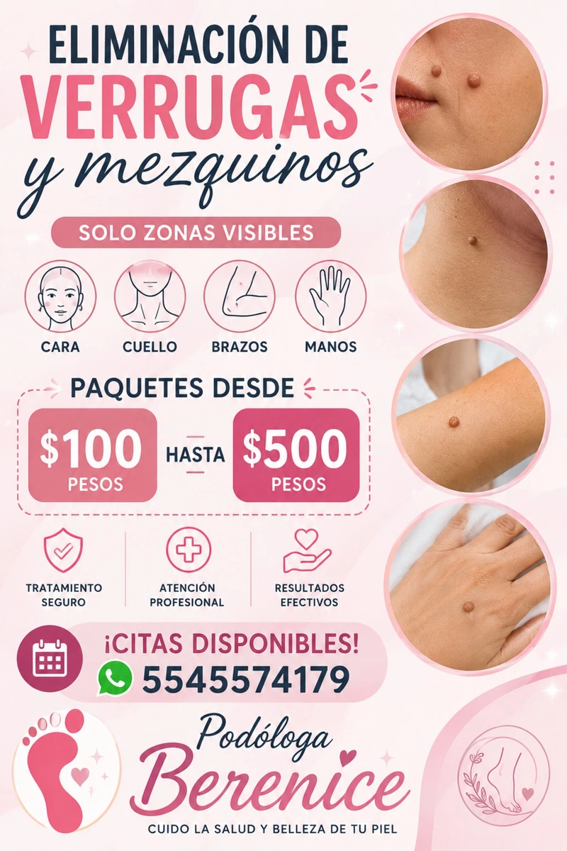 Eliminación de verrugas